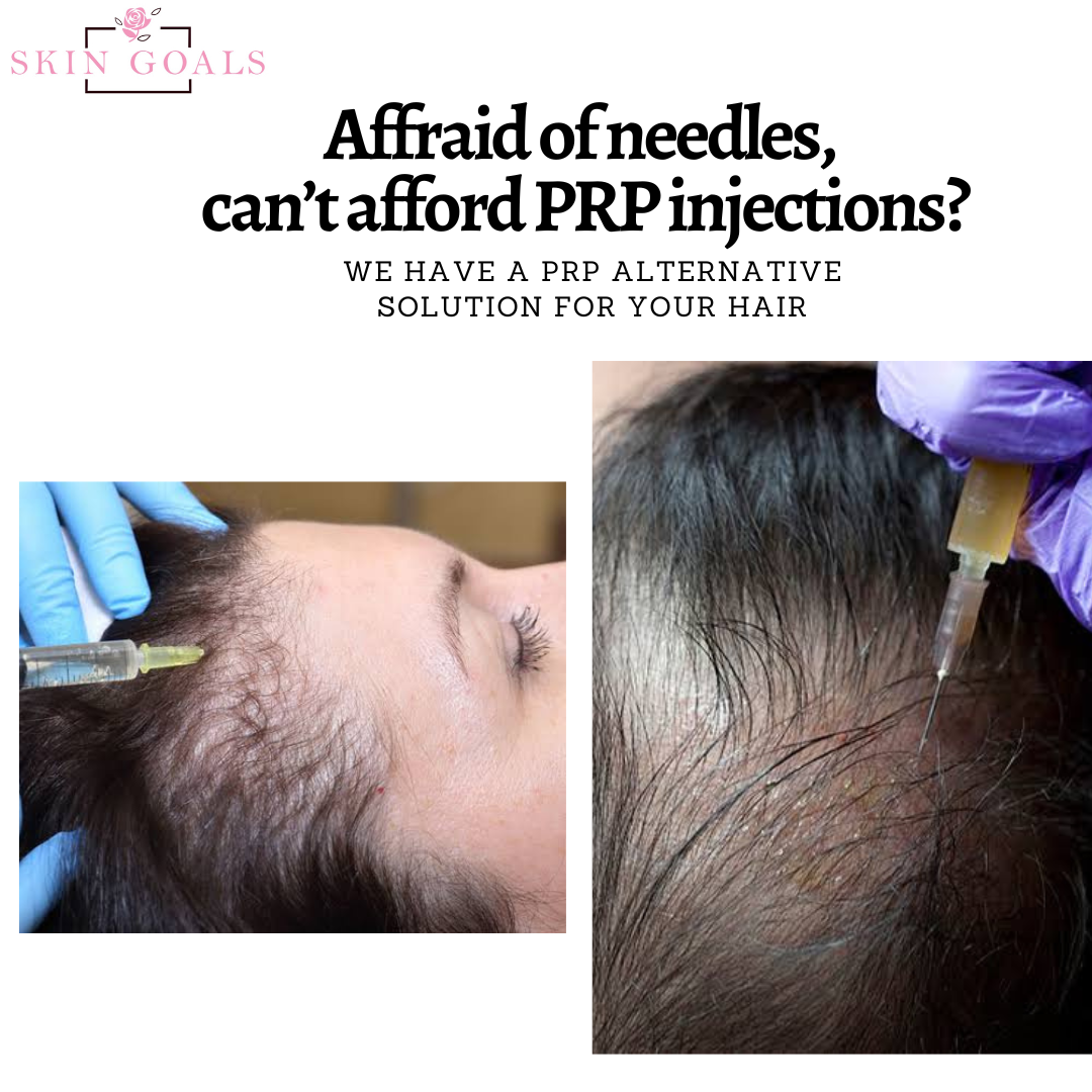 PRP Alternative Hair Oil